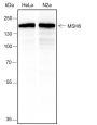 Anti-MSH6 Rabbit mAb