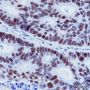 Anti-MSH6 Rabbit mAb