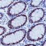 Anti-MSH6 Rabbit mAb