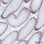 Anti-MSH6 Rabbit mAb
