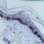 Anti-CD1a Rabbit mAb