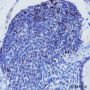 Anti-FOXP3 Rabbit mAb