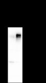 Anti-HER2/ErbB2 Mouse mAb