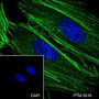Anti-beta Actin Mouse mAb
