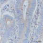 Anti-IkB alpha Mouse mAb