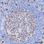 Anti-Ki67 Rabbit mAb