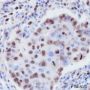 Anti-Ki67 Rabbit mAb