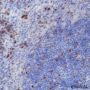 Anti-Ki67 Rabbit mAb