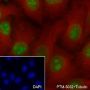 Anti-Ki67 Rabbit mAb
