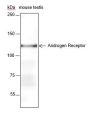 Anti-Androgen Receptor Rabbit mAb