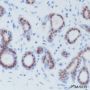 Anti-Androgen Receptor Rabbit mAb
