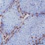 Anti-Androgen Receptor Rabbit mAb