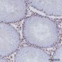 Anti-Androgen Receptor Rabbit mAb