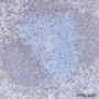 Anti-CD20 Rabbit mAb