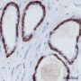 Anti-Keratin 5 Rabbit mAb