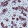 Anti-Keratin 5 Rabbit mAb