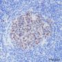 Anti-BCL6 Rabbit mAb