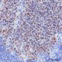 Anti-BCL6 Rabbit mAb