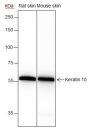 Anti-Keratin 10 Rabbit mAb