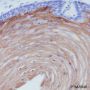 Anti-Keratin 10 Rabbit mAb