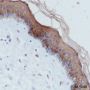 Anti-Keratin 10 Rabbit mAb