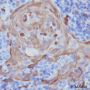 Anti-Keratin 10 Rabbit mAb