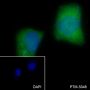 Anti-Keratin 10 Rabbit mAb