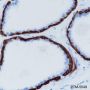 Anti-Keratin 14 Rabbit mAb
