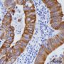Anti-Keratin 20 Rabbit mAb