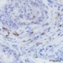 Anti-CD103 Rabbit mAb