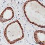 Anti-E-Cadherin Rabbit mAb