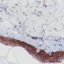 Anti-E-Cadherin Rabbit mAb