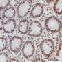 Anti-ERCC1 Rabbit mAb