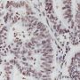 Anti-ERCC1 Rabbit mAb
