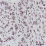 Anti-ERCC1 Rabbit mAb