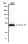 Anti-Keratin 18 Rabbit mAb