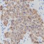 Anti-Keratin 18 Rabbit mAb