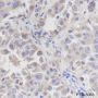 Anti-Tau Rabbit mAb