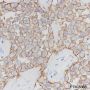 Anti-HER2/ErbB2 Rabbit mAb