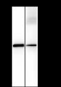 Anti-Keratin 8 Rabbit mAb