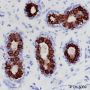 Anti-Keratin 8 Rabbit mAb
