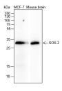 Anti-SOX2 Rabbit mAb