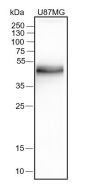 Anti-PD-L1 Rabbit mAb