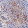 Anti-PD-L1 Rabbit mAb
