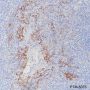 Anti-PD-L1 Rabbit mAb