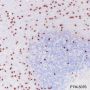 Anti-SOX10 Rabbit mAb