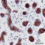 Anti-Keratin 6 Rabbit mAb