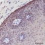 Anti-Keratin 6 Rabbit mAb