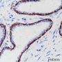 Anti-Keratin 6 Rabbit mAb