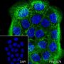 Anti-Keratin 6 Rabbit mAb